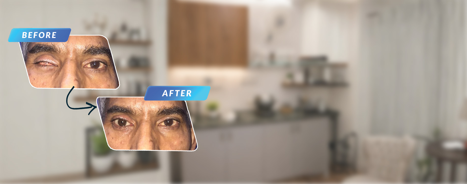 artificial eye